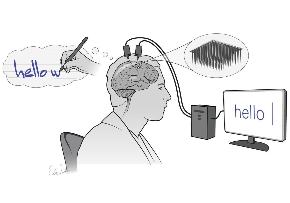 Teknologi Brain-Computer Interface: Gadget Masa Depan